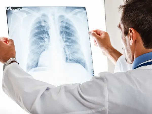 Association of HLA-mismatch with lung graft survival: A UNOS registry analysis